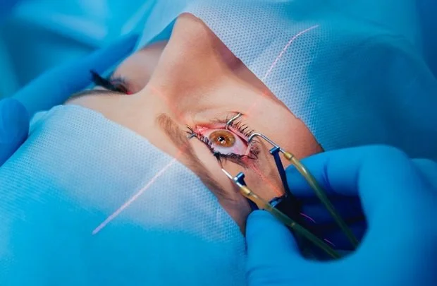 LASIK eye surgery procedure being performed by an eye specialist