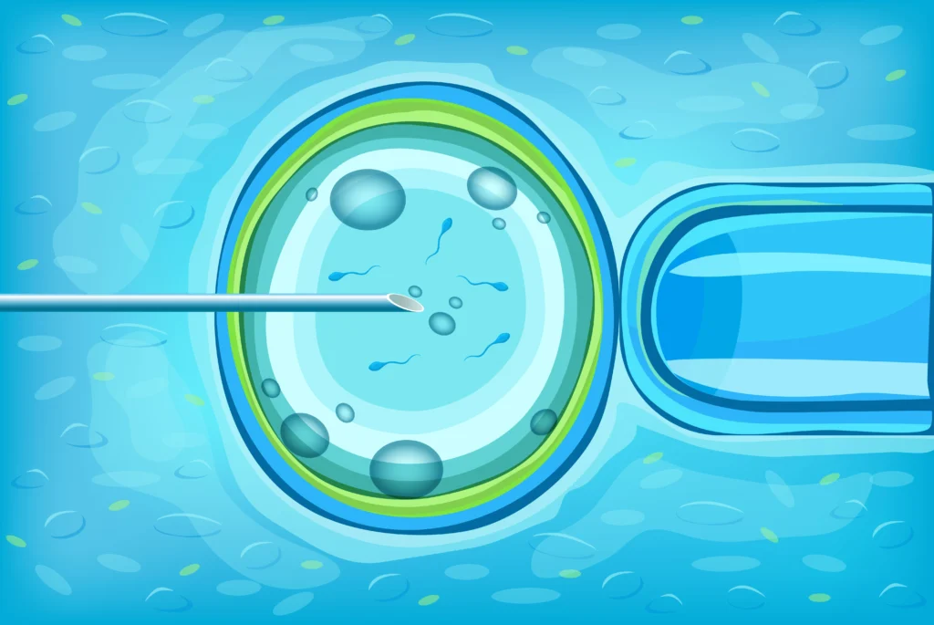 Egg freezing procedure helping women preserve fertility and plan future pregnancy with confidence and reproductive freedom.